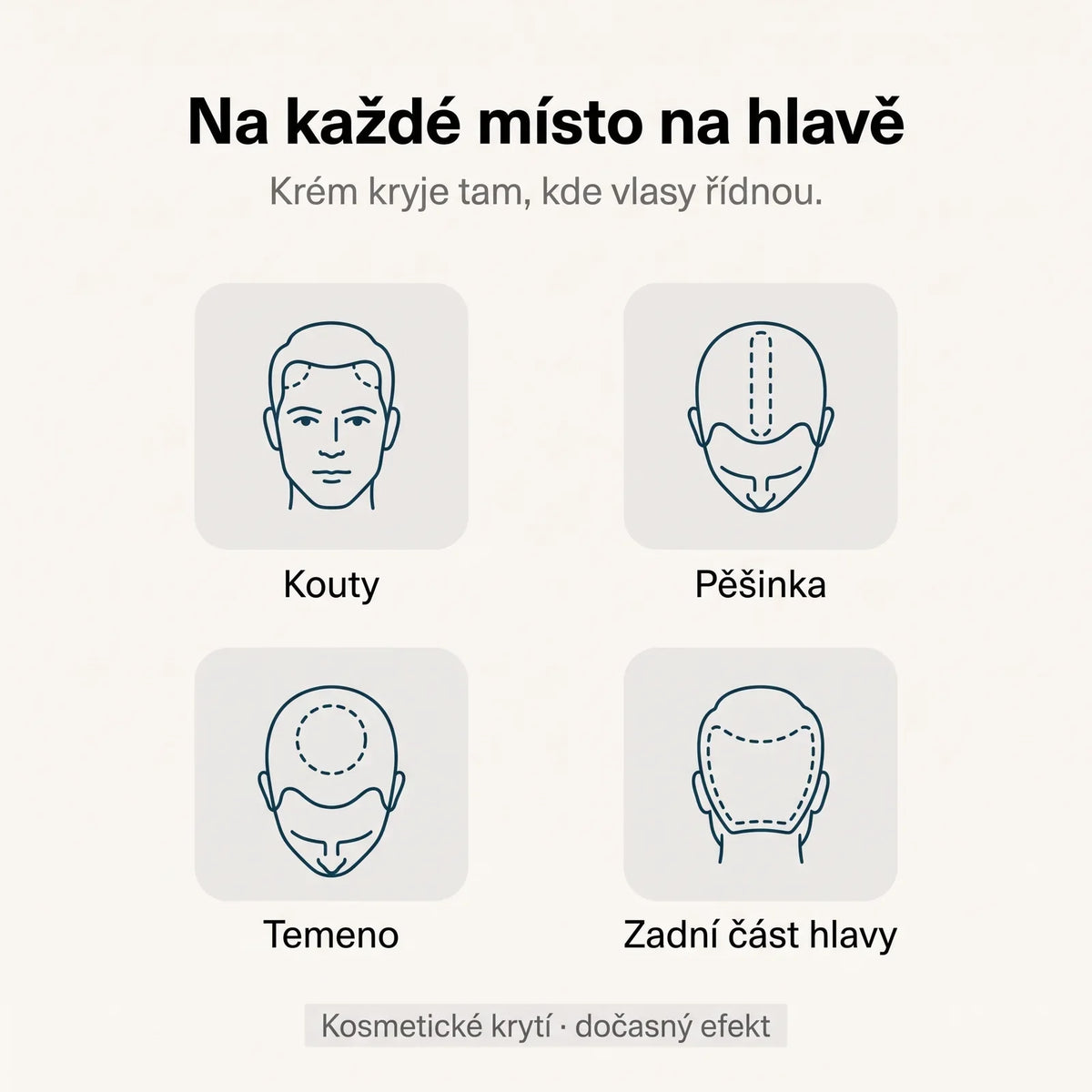 Na každé místo na hlavě – kouty, pěšinka, temeno, zadní část hlavy